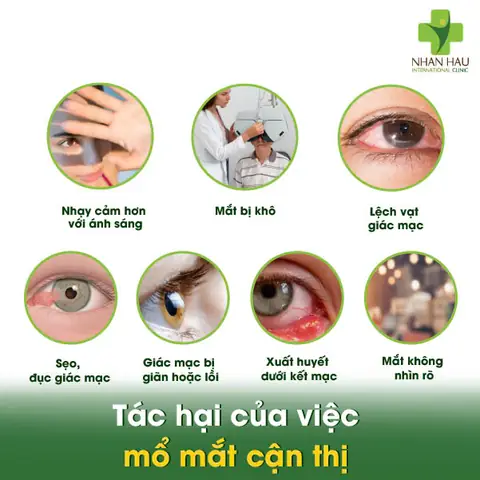 Mổ Mắt Cận Thị Có Ảnh Hưởng Gì Không