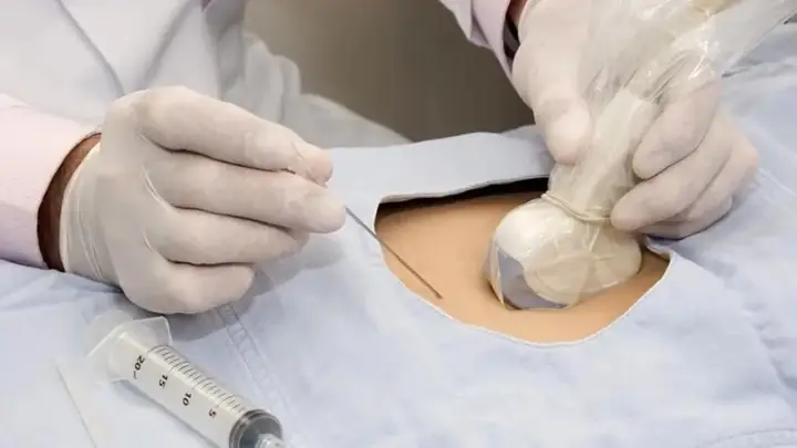 Siêu Âm 12 Tuần Đã Biết Trai Hay Gái Chưa? Thông Tin Chi Tiết